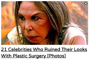 21 celebrities who ruined their looks with plastic surgery in native ads format.
